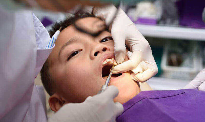 Tooth Extractions Mississauga