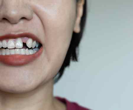 Knocked-out tooth care